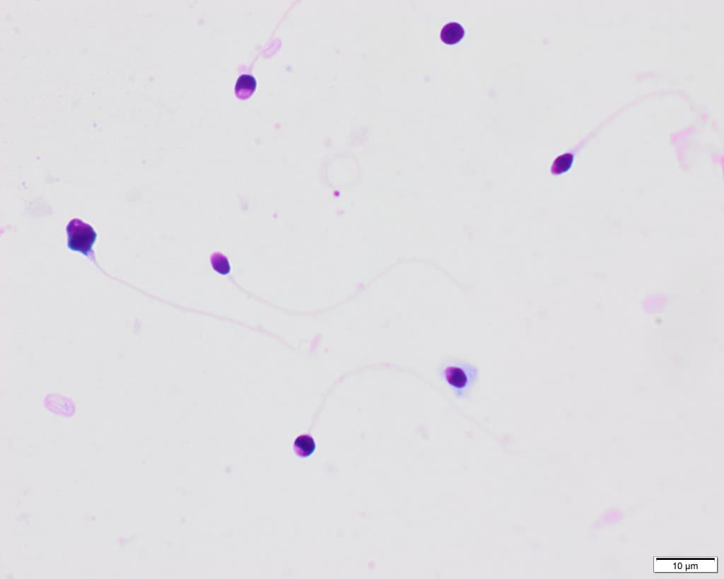Gefärbte Spermien zur Morphologie-Analyse