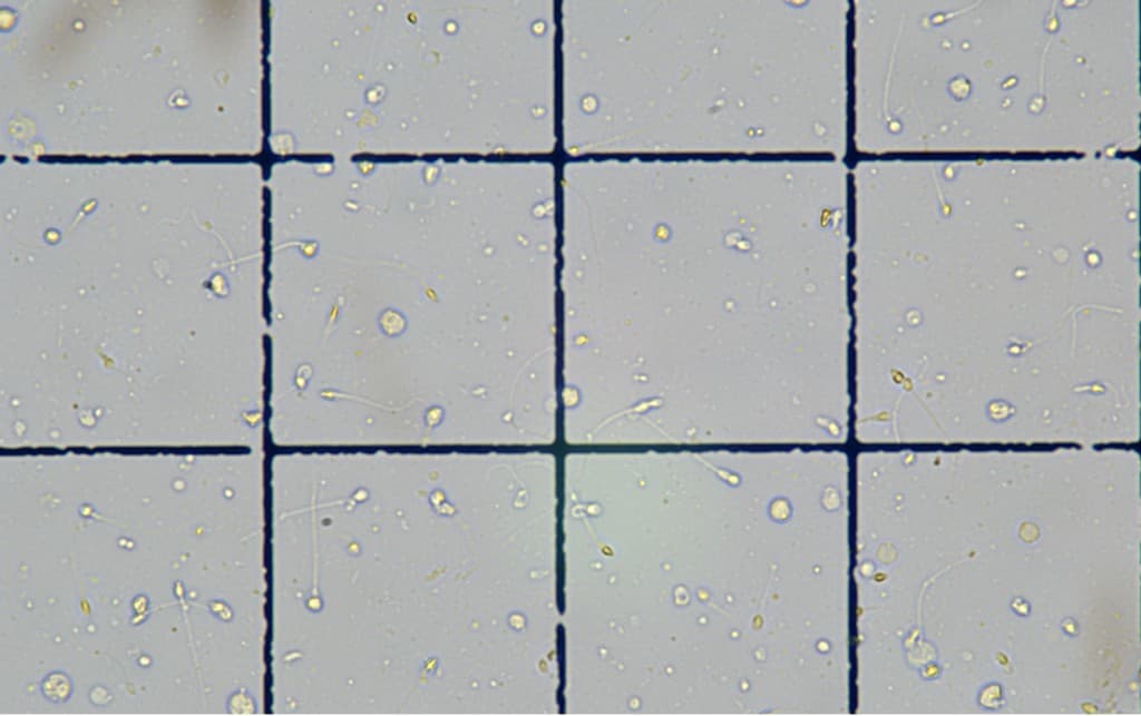 Neubauer-Zählkammer zur Bestimmung der Spermienkonzentration